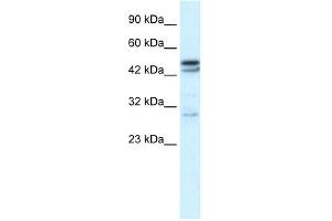 WB Suggested Anti-CHRNA3 Antibody Titration:  0.