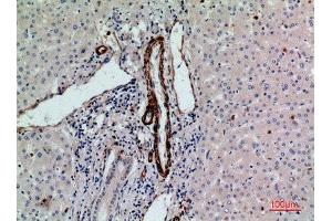 Immunohistochemistry (IHC) analysis of paraffin-embedded Human Liver, antibody was diluted at 1:100. (RHAG 抗体  (N-Term))
