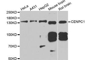 Western blot analysis of extracts of various cell lines, using CENPC antibody. (Centromere Protein C Pseudogene 1 (CENPCP1) 抗体)
