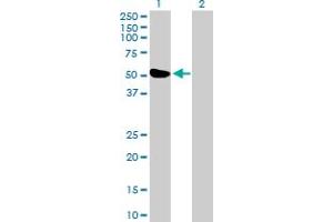 Western Blot analysis of ZBTB26 expression in transfected 293T cell line by ZBTB26 MaxPab polyclonal antibody. (ZBTB26 抗体  (AA 1-441))