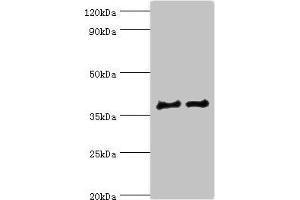 Western blot All lanes: CTSV antibody at 12 μg/mL Lane 1: Jurkat whole cell lysate Lane 2: MCF-7 whole cell lysate Secondary Goat polyclonal to rabbit IgG at 1/10000 dilution Predicted band size: 37 kDa Observed band size: 37 kDa (Cathepsin L2 抗体  (AA 105-334))