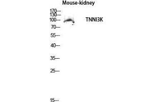 Western Blot (WB) analysis of Mouse Kidney lysis using TNNI3K antibody. (TNNI3K 抗体  (Internal Region))