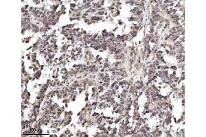 IHC analysis of TRIM24 using anti-TRIM24 antibody (ABIN7602358).