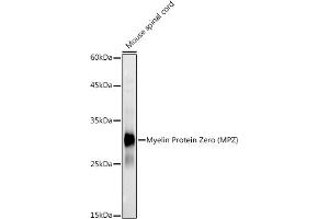 Western blot analysis of extracts of Mouse spinal cord, using Myelin Protein Zero (MPZ) antibody (ABIN3022393, ABIN3022394, ABIN1513218 and ABIN6218782) at 1:1000 dilution. (MPZ 抗体)