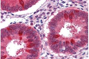 Immunohistochemistry (Formalin-fixed Paraffin-embedded Sections) (IHC (fp)) image for anti-RuvB-Like 2 (E. Coli) (RUVBL2) (AA 304-458) antibody (ABIN574138)