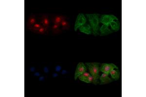ABIN7094736 and ABIN7098787 staining  cells by IF/ICC.