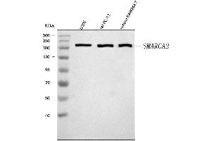 Western blot analysis of SMARCA2/BRM using anti-SMARCA2/BRM antibody (ABIN7601969).