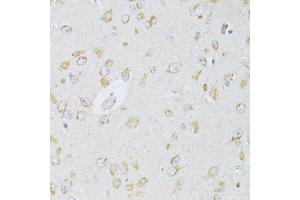 Immunohistochemistry of paraffin-embedded rat brain using NTS antibody (ABIN6290694) at dilution of 1:100 (40x lens). (Neurotensin 抗体)