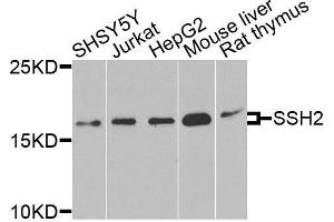 Western blot analysis of extracts of various cell lines, using SSH2 antibody. (SSH2 抗体  (AA 53-202))