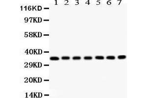 Anti- RACK1 antibody, Western blotting All lanes: Anti RACK1  at 0.