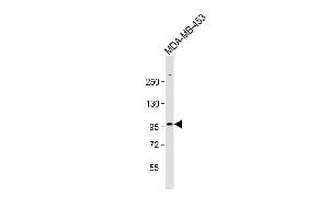 Anti-ZBTB49 Antibody (N-term) at 1:1000 dilution + MDA-MB-453 whole cell lysate Lysates/proteins at 20 μg per lane. (ZBTB49 抗体  (N-Term))