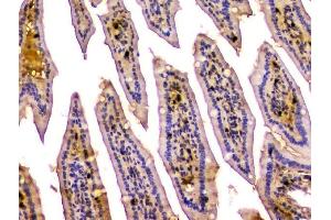 IHC analysis of CA2 using anti-CA2 antibody (ABIN6719533). (CA2 抗体  (AA 2-260))