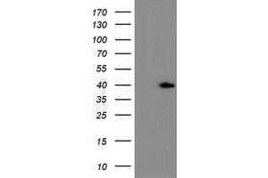 HEK293T cells were transfected with the pCMV6-ENTRY control (Left lane) or pCMV6-ENTRY ERCC1 (Right lane) cDNA for 48 hrs and lysed. (ERCC1 抗体)