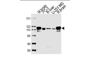 Lane 1: mouse brain lysates, Lane 2: PC-3 Cell lysates, Lane 3: rat liver Cell lysates, Lane 4: U-251 MG Cell lysates, Lane 5: rat brain Cell lysates, probed with USP5 (1340CT704. (USP5 抗体)