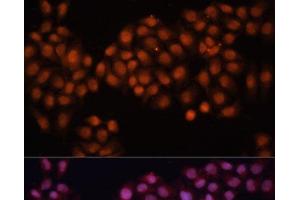 Immunofluorescence analysis of HeLa cells using CDC25A Polyclonal Antibody at dilution of 1:100 (40x lens). (CDC25A 抗体)