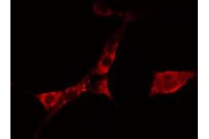 ABIN6274764 staining A549 cells by IF/ICC. (TROVE2 抗体  (N-Term))