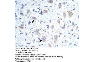 Human Brain (KCNIP1 抗体  (N-Term))