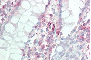 ABIN2613440 (5µg/ml) staining of paraffin embedded Human Colon. (IL17D 抗体  (Internal Region))