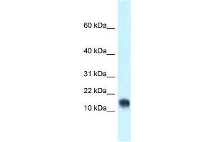 WB Suggested Anti-Lynx1 Antibody Titration: 1. (LYNX1 抗体  (Middle Region))