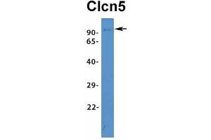 Host:  Rabbit  Target Name:  Clcn5  Sample Type:  Mouse Spleen  Antibody Dilution:  1. (Chloride Channel 5 抗体  (Middle Region))