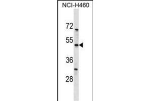 KCNK12 Antibody (C-term) (ABIN1537158 and ABIN2849703) western blot analysis in NCI- cell line lysates (35 μg/lane). (KCNK12 抗体  (C-Term))