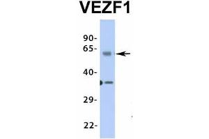 Western Blotting (WB) image for anti-Vascular Endothelial Zinc Finger 1 (VEZF1) (Middle Region) antibody (ABIN2776482)