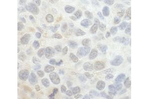 Immunohistochemistry (IHC) image for anti-SRSF Protein Kinase 1 (SRPK1) (AA 275-325) antibody (ABIN7448815) (SRPK1 抗体  (AA 275-325))