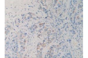 Figure. (SIRPA 抗体  (AA 105-324))