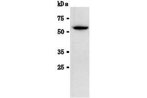 Western Blotting (WB) image for anti-Luciferase antibody (ABIN1108070) (Luciferase 抗体)