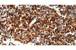 Immunohistochemistry of paraffin-embedded Human tonsil tissue using NCOR1 Polyclonal Antibody at dilution 1:100 (NCOR1 抗体)