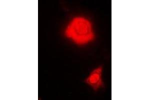 Immunofluorescent analysis of RBFOX3 staining in MCF7 cells. (NeuN 抗体)