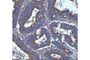 IHC analysis of Tripeptidyl peptidase II/TPPII/TPP2 using anti-Tripeptidyl peptidase II/TPPII/TPP2 antibody (ABIN7601293).