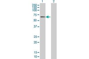 Western Blot analysis of XRCC4 expression in transfected 293T cell line by XRCC4 MaxPab polyclonal antibody. (XRCC4 抗体  (AA 1-336))