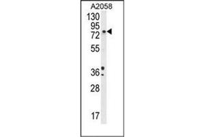 Western blot analysis of DBH Antibody (N-term) in A2058 cell line lysates (35ug/lane). (DBH 抗体  (N-Term))