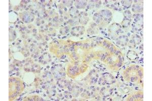 Immunohistochemistry (IHC) image for anti-Tumor Necrosis Factor Receptor Superfamily, Member 21 (TNFRSF21) (AA 371-655) antibody (ABIN7173876)