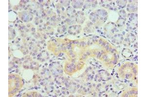 Immunohistochemistry of paraffin-embedded human pancreatic tissue using ABIN7173876 at dilution of 1:100 (TNFRSF21 抗体  (AA 371-655))
