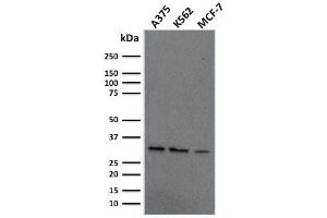 Western Blot Analysis of Human A375, K562, MCF-7 cell lysate using Replication Protein A2 Mouse Monoclonal Antibody (RPA2/2106). (RPA2 抗体)