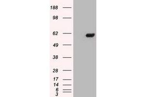 Image no. 4 for anti-Checkpoint Kinase 2 (CHEK2) antibody (ABIN1497499) (CHEK2 抗体)
