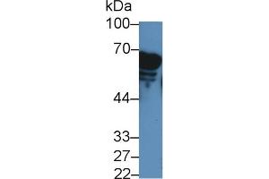 Detection of AMY2A in Rat Serum using Polyclonal Antibody to Amylase, Alpha 2A (AMY2A) (AMY2A 抗体  (AA 201-473))