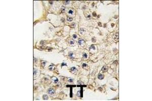Formalin-fixed and paraffin-embedded human testis tissue reacted with EPHA10 antibody (N-term), which was peroxidase-conjugated to the secondary antibody, followed by DAB staining. (EPH Receptor A10 抗体  (N-Term))