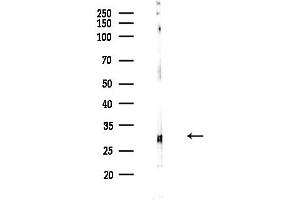 Western blot analysis of lysates from COLO205 cells, using MRPL4 Antibody at 1/1000 dilution.