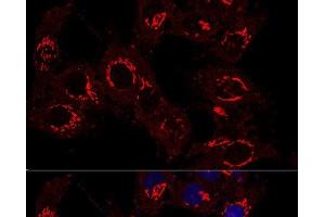 Confocal immunofluorescence analysis of Hela cells using GM130 Polyclonal Antibody at dilution of 1:400. (Golgin A2 (GOLGA2) 抗体)