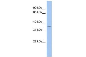 WB Suggested Anti-MPST Antibody Titration:  0. (MPST 抗体  (Middle Region))