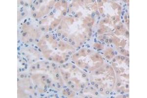 IHC-P analysis of Human Tissue, with DAB staining. (L1CAM 抗体  (AA 218-423))