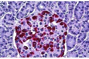 Human Pancreas, Islets of Langerhans: Formalin-Fixed, Paraffin-Embedded (FFPE) (HGS 抗体  (AA 451-500))