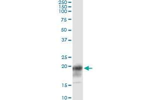 Immunoprecipitation of CD247 transfected lysate using anti-CD247 monoclonal antibody and Protein A Magnetic Bead , and immunoblotted with CD247 MaxPab rabbit polyclonal antibody. (CD247 抗体  (AA 1-164))