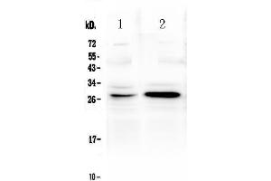 Western blot analysis of TNFRSF18 using anti-TNFRSF18 antibody . (TNFRSF18 抗体  (AA 178-241))