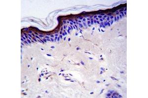 Immunohistochemistry (IHC) image for anti-Tumor Protein P53 (TP53) (AA 33-62) antibody (ABIN3029394)