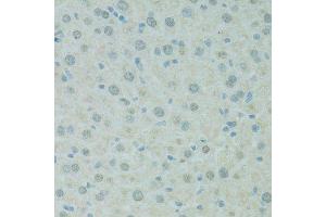 Immunohistochemistry (Paraffin-embedded Sections) (IHC (p)) image for anti-Scaffold Attachment Factor B (SAFB) (AA 1-200) antibody (ABIN6147357)