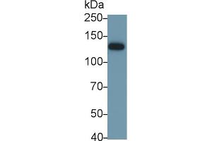 Detection of ITGaV in Mouse Stomach lysate using Polyclonal Antibody to Integrin Alpha V (ITGaV) (CD51 抗体  (AA 71-322))
